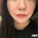 오퍼스 - 해운대구 구남로 49 | 압구정피부과 콜라겐부스터 올리디아 오퍼스의원 잔주름 개선 내돈내산 후기 (비포에프터 대공개)