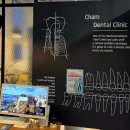 아프지않은행복치과의원 | 치과/유천동 아프지 않은 참 플랜트치과 추천! 임플란트 이벤트 방문 솔직후기/유공자 할인