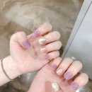 난이손톱