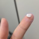 리즈약국 | 아젤리아크림 약국 가격, 파는곳 따가움없이 사용법