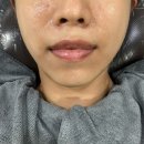 김은영뷰티# | 이대 김은영 코스메틱 에어썬더 케어 2회차 방문 후기 (내돈내산)