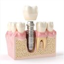 일산웰치과의원 이미지