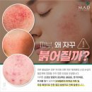 딜라잇6진해 | (6월 할인) 급속진정 레스큐세럼x카밍젤마스크