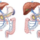 식도정맥류[esophageal varix] 이미지