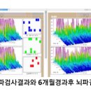 뉴로아이 이미지