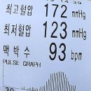 고혈압의 합병증 | 고혈압낮추는방법