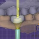DEN치과기공소 이미지