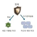 의학과한방(동영상):전신 홍반성 낭창(루푸스) (Systemic Lupus Erythematosus) 이미지