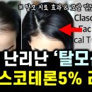 클라스코인 | 탈모신약 클라스코테론 5%