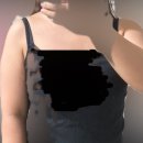 신사굿약국 | 팔지방흡입 내돈내산 후기 가격 압박복 통증 관리 준비물 총정리