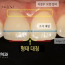 플러스덴치과의원 네이버블로그