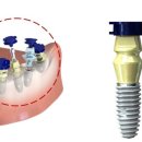 (주)네오바이오텍 이미지