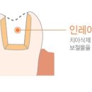 란치과기공소 이미지