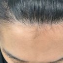 모디헤어플란트의원 이미지