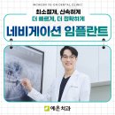 인천 남동구 임플란트 치과 비용 정보, 치료비 70%까지 정부지원금 받는 방법