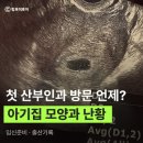 신일자동차서비스 | 임신 5주차 첫 산부인과 방문 (극초기 증상, 아기집 모양과 난황, 성동구 보건소)