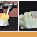 보일치과기공소 이미지