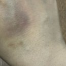 동해물약국 | 첫 SRT 타고 이동했는데 결국 B형 독감… 가방 분실까지 기차 유실물센터 후기