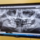 서울라온치과의원 | 차니지육아_ 이천 서울쥬니어치과의원 방문 후기 / 이천 소아 치과 / 전화 예약 / 영유아 치아 검진...