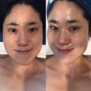 인토탈뷰티 | 한에스테틱 동백역피부관리 손맛좋은 환절기보습관리 받은 후기