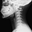 설한의원 이미지