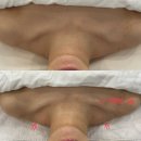 동성로 관광안내소 | 예민한 피부도 받을 수 있는 대구신부관리 '유에보에스테틱' 윤곽관리 후기