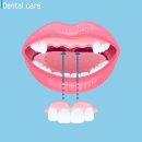 재성치과의원 | [대전중구치과] 앞니모양 바꾸자