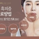 헤나염색 네이버블로그