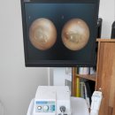 하이프리미엄보청기 이미지