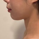 은솔어린이집 | 당산 피부관리 더빛날에스테틱&amp;왁싱 뽀샵턱 완성❤️