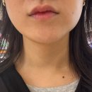 광나라 | 홈모드써마리프트 8주차 후기