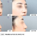 일치성형외과의원 이미지