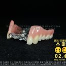 스마일기공소 이미지