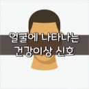 얼굴에 나타나는 건강 이상 신호는?? 이미지