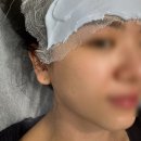 광주 헤어라인 왁싱, 눈썹 디자인 왁싱 받고 온 후기 | 웨딩준비편