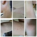 안암한의원 | 교통사고 후 진료 병원 후기 및 진료기록~^^(by 우 신향 병원, 고대 안암 병원, 청량리 손한의원)