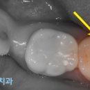 이하루치과의원 이미지