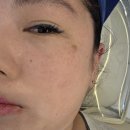 미모&힐링 | 나주 피부관리 잘하는 곳 미모오른 트라이엄 관리로 모공부터 탄력까지 솔직 후기