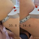 CU남천수영로점 | 남천동 바디관리 에너지테라피로 팔뚝관리 잘하는 레몬트리에스테틱 남천점 솔직후기