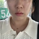 청담쟈스민라인의원 | 청담 피부과의원 세르프 300샷 유명한 곳 통증, 솔직 후기!!