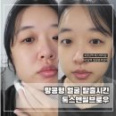 강남역 에스테틱샵 땅콩형 얼굴 톡스앤필브로우에서 라인 정리한 후기