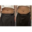 수원-1470 | 수원에스테틱 추천 에스테틱 다리아 복부 슬리밍 관리 후기