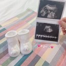 합천애견인공수정센터 | 난임부부 임신 성공기 / 화학적유산 / 고프로락틴혈증 / 배란유도제