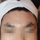 초이몽 | 용산에스테틱, 용산역피부관리 초이몽에스테틱에서 남자눈썹왁싱 후기