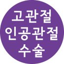 고관절통증으로 망가진 고관절 치료는 인공관절수술잘하는곳에서 이미지