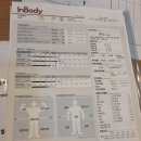 예술로3L | 인천 걸그룹주사 다이어트하기 지방분해주사 1회차
