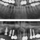 진플란트치과의원 이미지