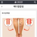 지긋지긋한 다리시림...!원인을 파악해보다..!!
