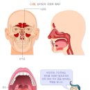 호흡기관련질병수술비보장 특별약관 이미지