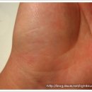 스킨트리 이미지